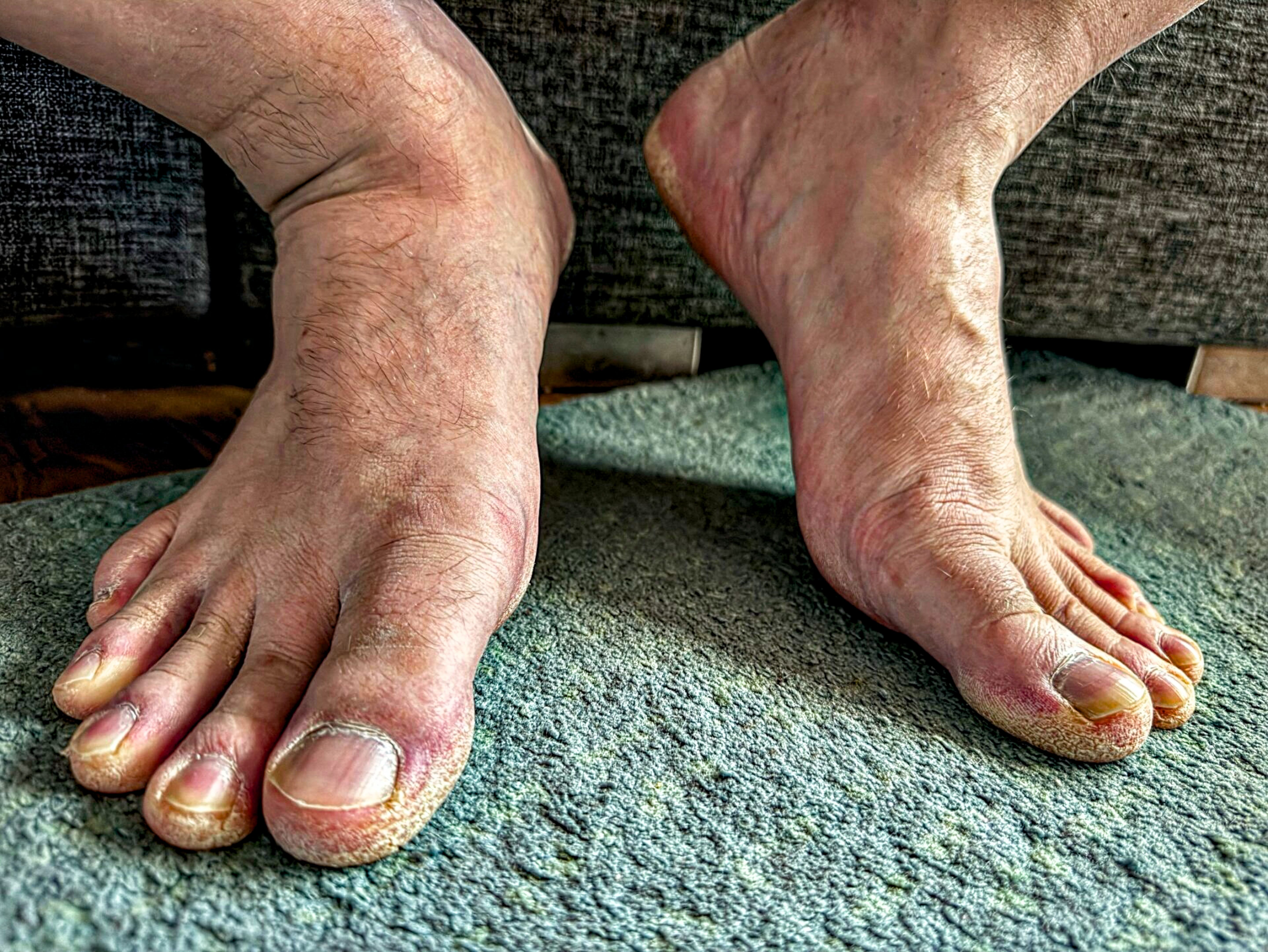 feet.jpeg
