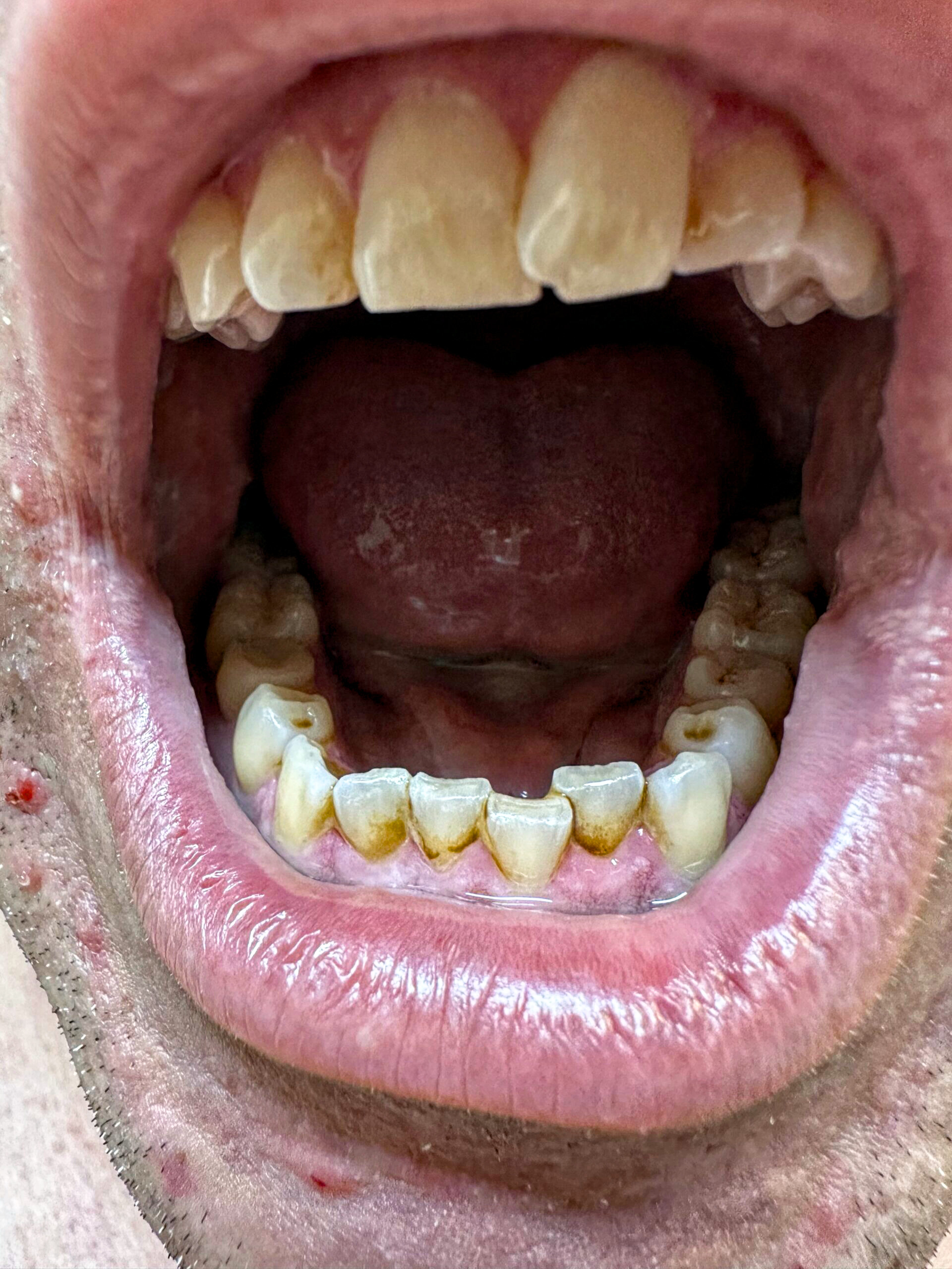 mouth.jpeg