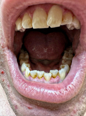 mouth.jpeg